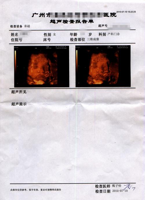 三维成像报告单_副本